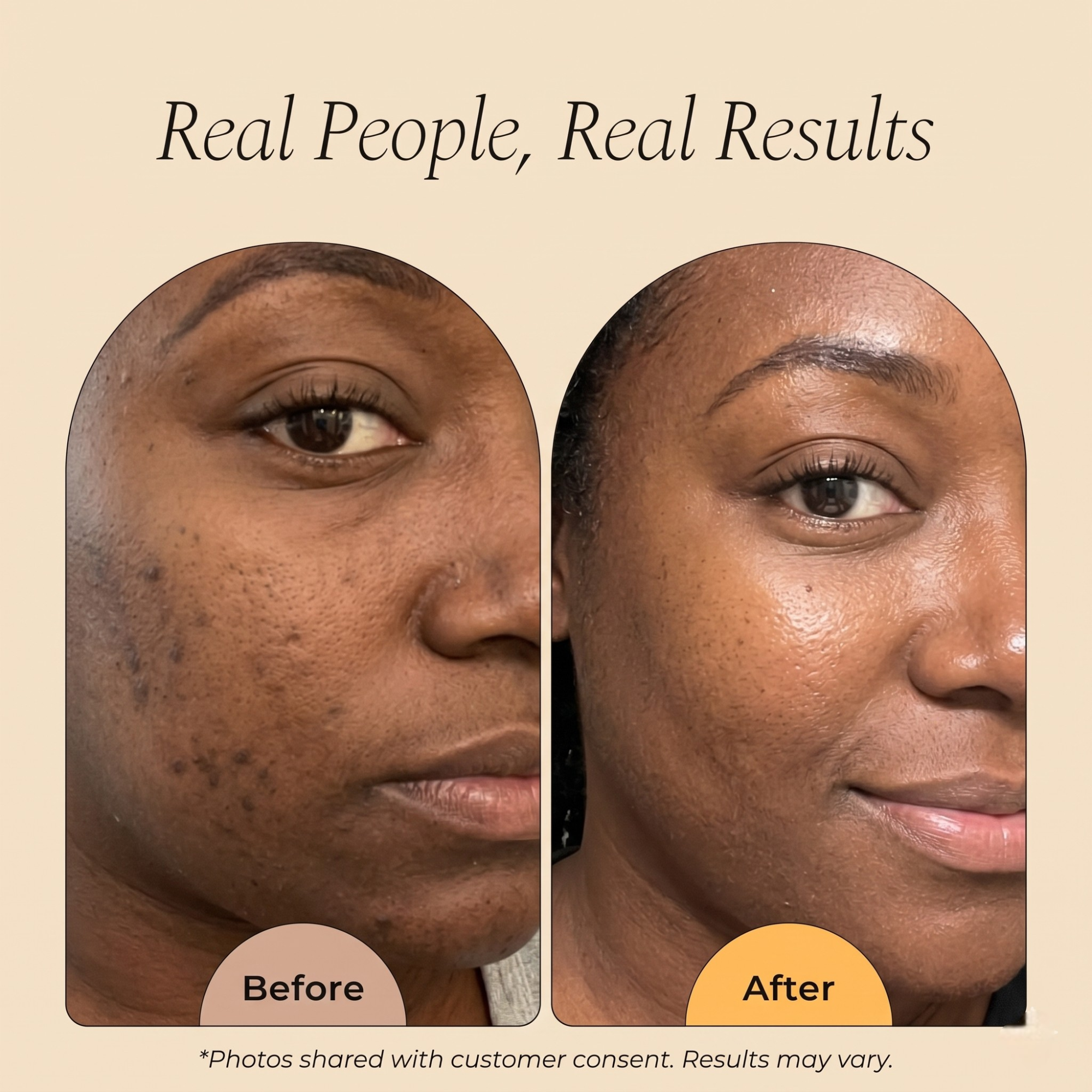 Turmeric Dark Spot Removal Scrub | Brightening Body Scrub
