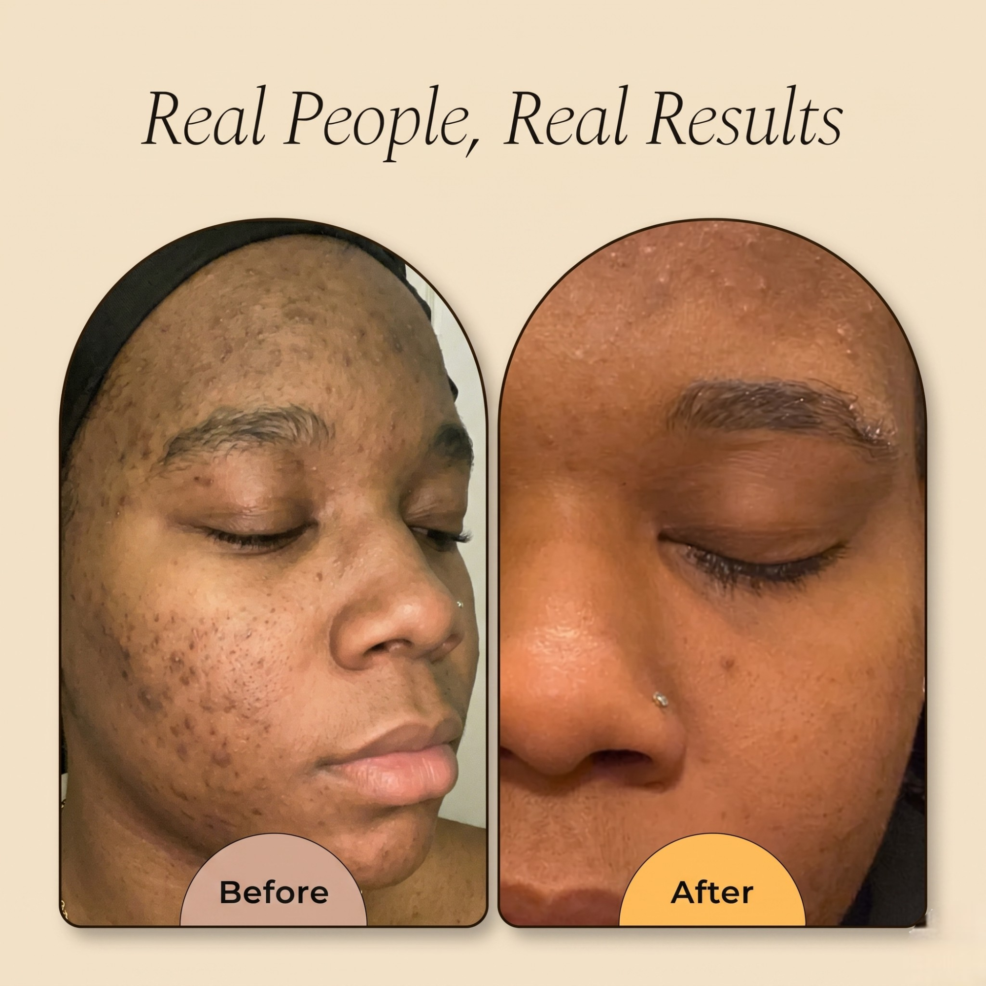 Dark Spot & Hyperpigmentation Soap | Natural Turmeric Bar